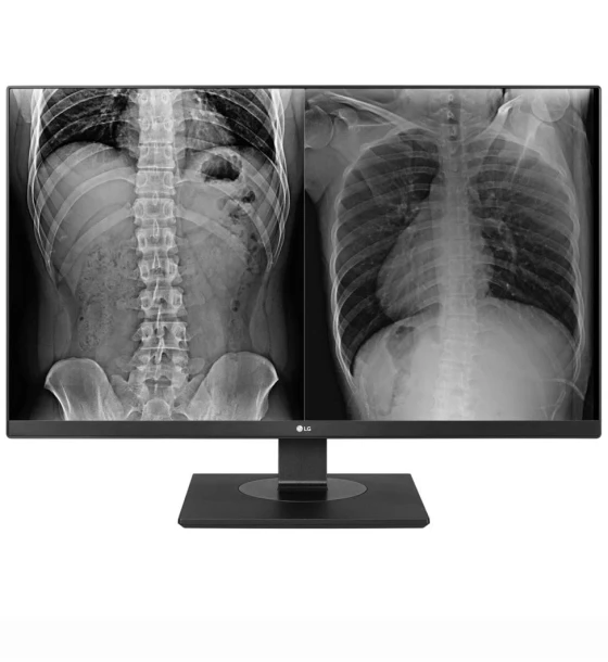 Monitor LG 27 inch 27HJ713C-B.AEE, 16:9, IPS, 3840x2160, 60Hz, GtG 14ms, Luminozitate max 350 cdmp, Contrast static 1000:1, Colours 1.07B